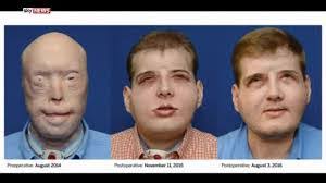 Patrick Hardiman's Instagram, Twitter & Facebook