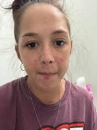 Hi Lupus warriors, I have a question/ interesting thing that just happened.  I have used both LabCorp and Quest in the past for my labwork. Recently  Quest mostly. I got an email