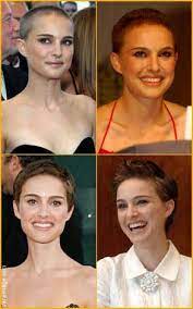 Growing Out Hair Shaved Head Women Chemo Hair