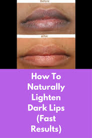 How To Naturally Lighten Dark Lips Fast Results First You Will Need A Lip Scrub And Its Very Easy To Make Lip Scrub Lip Lightening Dark Lips Honey Lip Scrub