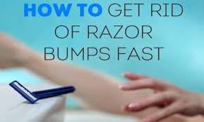 Apply too much force when shaving. 6 Home Remedies To Get Rid Of Razor Bumps Fast Skin Beauty