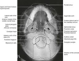 Image result for Skull XRay