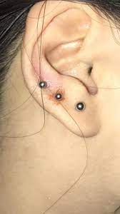 Why Is My 1 Year Old Lobe Piercing Bleeding Legitpiercing