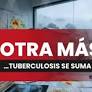 ECOSUR documenta brechas en tuberculosis en pueblos originarios