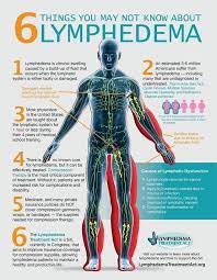 Various immune system cells trap germs in the lymph nodes and activate the creation of special antibodies in the blood. Why I Became A Lymphedema Advocate Guest Post By Rebecca Sharp Nancy S Point Lymphedema Treatment Lymphedema Awareness Lymphedema