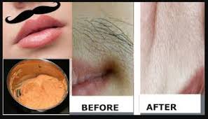 Removing upper lip hair can be a simple procedure and will be part of daily routine when you know the correct method. Beauty Hacks Remove Upper Lip Hair In These Ways Newstrack English 1