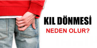 Kil Donmesi Neden Olur Tedavisi Nasil Olur Fib Haber Nevsehir Haberleri