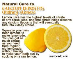 Lemons Kidney Stones Calcium Deposits Kidney Stones Remedy How To Squeeze Lemons