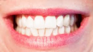 Zahnarzt kinderzahnarzt kieferorthopäde zahnärztlicher notdienst, auch physiotherapie und osteopathie. Zahneknirschen Oskar Kuhmann Osteopathie