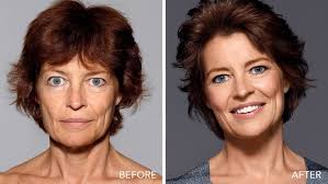 Art hardings instant facelift secrets? Bobbi Brown S Makeup Facelift