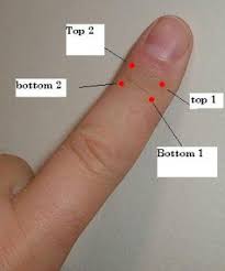 Pin On Acupuncture And Healthy Living