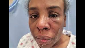 News 12 speaks exclusively to victim in Middletown domestic violence  attack, arson