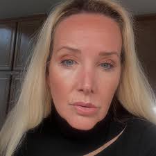 Leslie Joy Dammer (@skinliv) • Instagram photos and videos