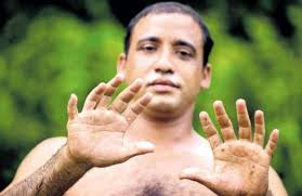 Ale pre niektorých je takýto fenomén extrémne zriedkavý a niekto sa s touto nedostatok vápnika môže poškodiť vaše zdravie. Anomalie Vyvoja Koncatin Co Robit Ak Ma Dieta Sest Prstov Alebo Prstov