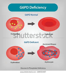 Image result for G6PD Deficiency Detection