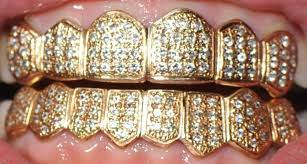 Gold Diamonds Grillz Diamond Grillz Trendy Jewelry