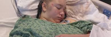 16-year-old girl recovers from alleged beating as suspect is brought to  Whitfield Co.