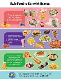Check spelling or type a new query. Safe Foods To Eat While In Braces Manhattan Bridge Orthodontics