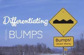 Usually an ingrown hair in nose heals on its own, but if it does not, clinical intervention is essential. Differentiating Bumps Renee Cotter Md Gynecologists
