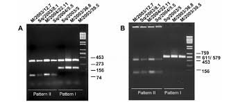 Restriction fragment length polymorphism was the first technique established to examine variable lengths of dna fragments formed through dna digestion. Restriction Fragment Length Polymorphism Rflp Analysis Of Polymerase Download Scientific Diagram