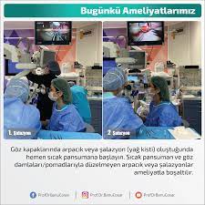 Goz Kapaklarinda Arpacik Veya Salazyon Yag Kisti Olustugunda Hemen Sicak Pansumana Baslayin Sicak Pansuman Ve Goz Damlalari Pomadlariyla Duzelmeyen Arpaci Arp