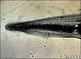 Image result for Pinworm Test