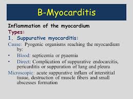 The duration of problems can vary from hours to months. Cardiovascular System Ppt Download