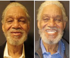 Root Laboratory(@root_dental_laboratory) • Instagram 사진 및 동영상