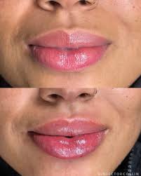 Collin Wang, BSN, RN