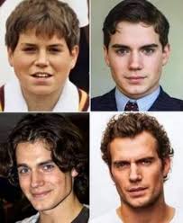 The Man of Stee - Bullied as 'Fat Cavill,' Now Superman:... | Facebook