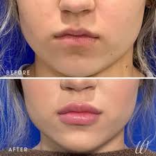 Board-Certified Plastic Surgeon in Baton Rouge & Hammond, LA