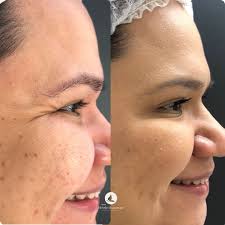 Centro Michelle Albuquerque(@centromichellealbuquerquee) • Instagram写真と動画