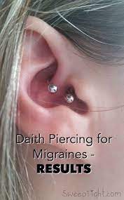 The Ear Piercing For Migraines Results After 31 Days Ear Piercing For Migraines Migraine Piercing Natural Headache Remedies