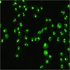 Image result for ANA Staining Pattern