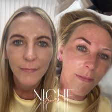 Niche