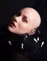 Manningtree model lost her hair at 13