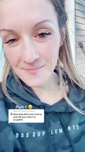 Crossfit After Tummy Tuck