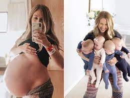 This Mom S Side By Side Photos Show That Having Quadruplets Is 100 No Joke Quadruplets Pregnant Belly Huge Mom Belly