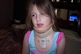 Head Trauma Can Be Fun!