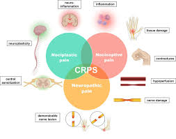 Image result for Pain Disorder