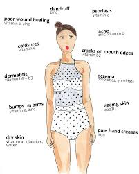 68 Scientific Acne Food Chart