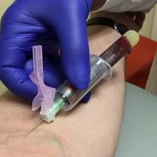 It no longer wakes me up at night (it did for months). Venipuncture Wikipedia