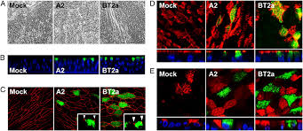 Respiratory syncytial virus (rsv) infection is the most common cause of bronchiolitis and pneumonia among infants under 1 year of age. In Vitro Modeling Of Respiratory Syncytial Virus Infection Of Pediatric Bronchial Epithelium The Primary Target Of Infection In Vivo Pnas