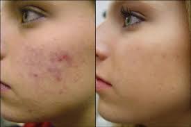 L'huile de nigelle a de multiples bienfaits autant pour la peau que pour les cheveux. L Huile De Ricin Un Moyen Naturel Pour S Embellir Spas De France