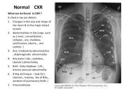 Interpretation of the chest x ray. Medical Online Normal Chest X Ray Interpretation Facebook