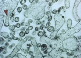 Image result for Lassa Fever