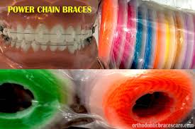 Reach out to your service provider directly to enroll in the program. Power Chain Braces 101 Types Colors When Do You Get Orthodontic Braces Care