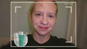 Scott Alan Berk TV Commercials