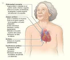 Palpitaciones Que Es Sintomas Y Tratamiento Top Doctors