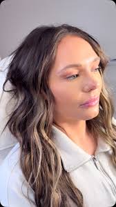 Fresh lippies and we added a little filler to the tip of the nose with  restylane kysse. , #lipfiller #restylanekysse #lips #nursepractitioner